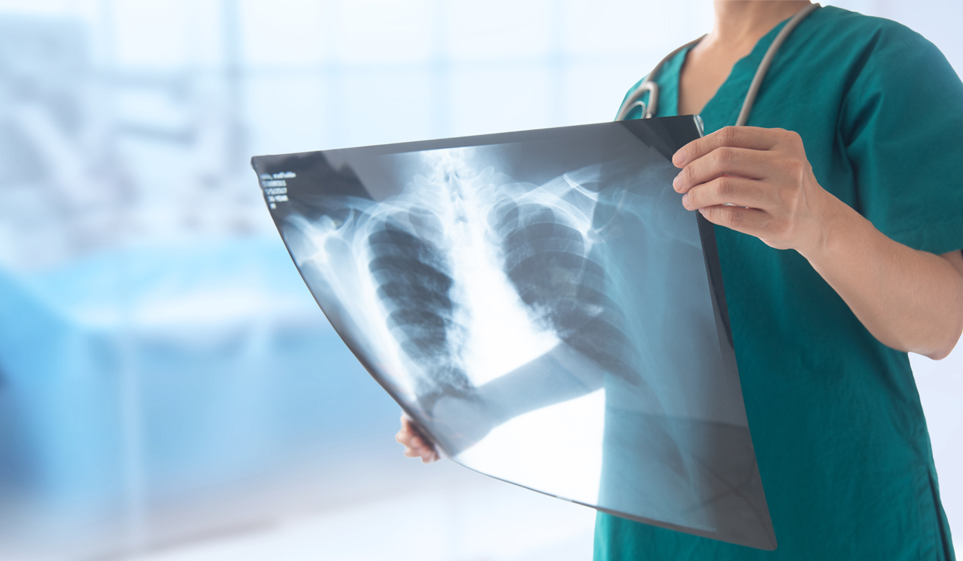 Exploración pulmonar: ¿cómo minimizar la exposición a la radiación sin sacrificar la calidad de la imagen?